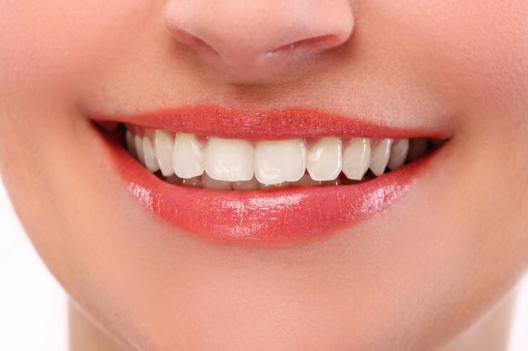 Smile Design